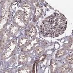 Laminin beta-2 Antibody in Immunohistochemistry (Paraffin) (IHC (P))