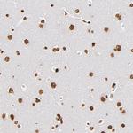 ILF3 Antibody in Immunohistochemistry (Paraffin) (IHC (P))