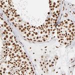 ILF3 Antibody in Immunohistochemistry (Paraffin) (IHC (P))