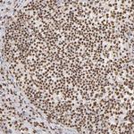 ILF3 Antibody in Immunohistochemistry (Paraffin) (IHC (P))