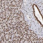 ILF3 Antibody in Immunohistochemistry (Paraffin) (IHC (P))