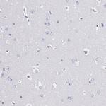 FIBB Antibody in Immunohistochemistry (Paraffin) (IHC (P))