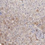 FIBB Antibody in Immunohistochemistry (Paraffin) (IHC (P))