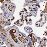 FIBB Antibody in Immunohistochemistry (Paraffin) (IHC (P))