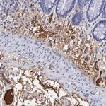 FIBB Antibody in Immunohistochemistry (Paraffin) (IHC (P))