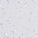 FIBB Antibody in Immunohistochemistry (Paraffin) (IHC (P))