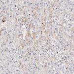 FIBB Antibody in Immunohistochemistry (Paraffin) (IHC (P))