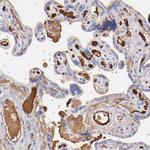 FIBB Antibody in Immunohistochemistry (Paraffin) (IHC (P))