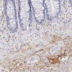 FIBB Antibody in Immunohistochemistry (Paraffin) (IHC (P))