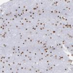 TRF2 Antibody in Immunohistochemistry (Paraffin) (IHC (P))