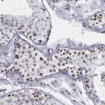 TRF2 Antibody in Immunohistochemistry (Paraffin) (IHC (P))