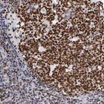 TRF2 Antibody in Immunohistochemistry (Paraffin) (IHC (P))