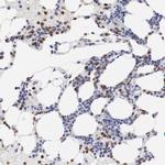 FGR Antibody in Immunohistochemistry (Paraffin) (IHC (P))