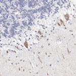 FGR Antibody in Immunohistochemistry (Paraffin) (IHC (P))