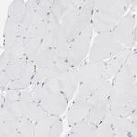 FGR Antibody in Immunohistochemistry (Paraffin) (IHC (P))