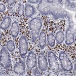 IRF4 Antibody in Immunohistochemistry (Paraffin) (IHC (P))