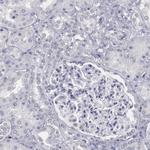 IRF4 Antibody in Immunohistochemistry (Paraffin) (IHC (P))