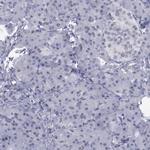 IRF4 Antibody in Immunohistochemistry (Paraffin) (IHC (P))