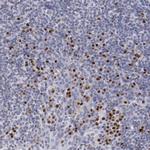 IRF4 Antibody in Immunohistochemistry (Paraffin) (IHC (P))