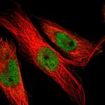 LEF1 Antibody in Immunocytochemistry (ICC/IF)