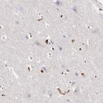 Vinculin Antibody in Immunohistochemistry (Paraffin) (IHC (P))