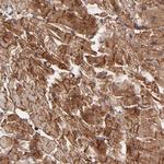 Vinculin Antibody in Immunohistochemistry (Paraffin) (IHC (P))