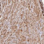 Vinculin Antibody in Immunohistochemistry (Paraffin) (IHC (P))