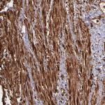 Vinculin Antibody in Immunohistochemistry (Paraffin) (IHC (P))