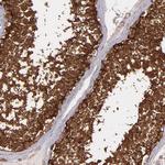 Vinculin Antibody in Immunohistochemistry (Paraffin) (IHC (P))