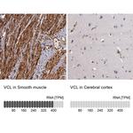 Vinculin Antibody