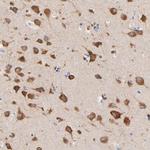 HS3ST1 Antibody in Immunohistochemistry (Paraffin) (IHC (P))