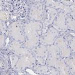 IRF8 Antibody in Immunohistochemistry (Paraffin) (IHC (P))