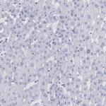 IRF8 Antibody in Immunohistochemistry (Paraffin) (IHC (P))