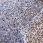 IRF8 Antibody in Immunohistochemistry (Paraffin) (IHC (P))