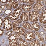 MVP Antibody in Immunohistochemistry (Paraffin) (IHC (P))