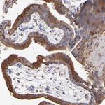 MVP Antibody in Immunohistochemistry (Paraffin) (IHC (P))