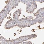 MRP4 Antibody in Immunohistochemistry (Paraffin) (IHC (P))