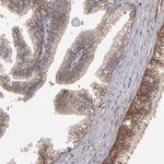 MRP4 Antibody in Immunohistochemistry (Paraffin) (IHC (P))