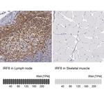 IRF8 Antibody