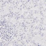 IRF8 Antibody in Immunohistochemistry (Paraffin) (IHC (P))