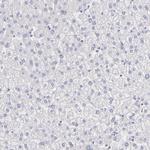 IRF8 Antibody in Immunohistochemistry (Paraffin) (IHC (P))