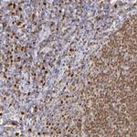 IRF8 Antibody in Immunohistochemistry (Paraffin) (IHC (P))