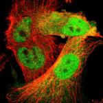 CDK6 Antibody in Immunocytochemistry (ICC/IF)