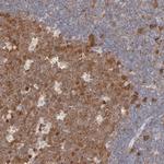 CDK6 Antibody in Immunohistochemistry (Paraffin) (IHC (P))