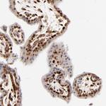 CDK6 Antibody in Immunohistochemistry (Paraffin) (IHC (P))