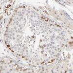 CDK6 Antibody in Immunohistochemistry (Paraffin) (IHC (P))