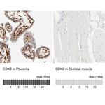 CDK6 Antibody