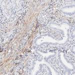 ITGA5 Antibody in Immunohistochemistry (Paraffin) (IHC (P))