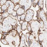 ITGA5 Antibody in Immunohistochemistry (Paraffin) (IHC (P))