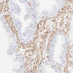 ITGA5 Antibody in Immunohistochemistry (Paraffin) (IHC (P))